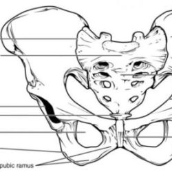 Label the image of the pelvic girdle