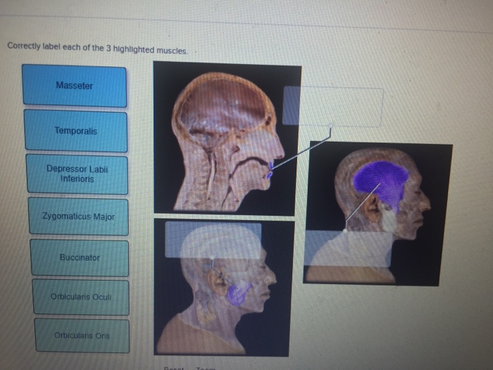 Correctly label each of the 3 highlighted muscles