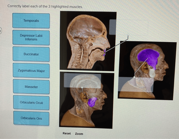 Correctly label each of the 3 highlighted muscles